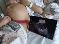 Nemocnice Písek pořídila pro rodičky moderní přenosný ultrazvuk 